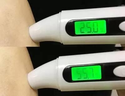 碘伏真的能美白护肤吗